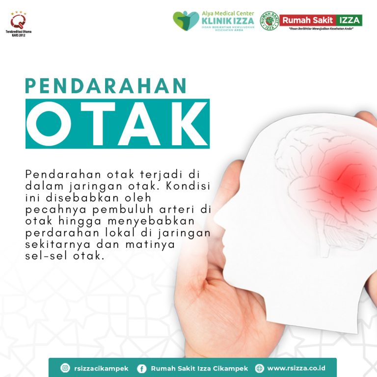 Mengenal Pendarahan Otak Penyebab dan Gejala