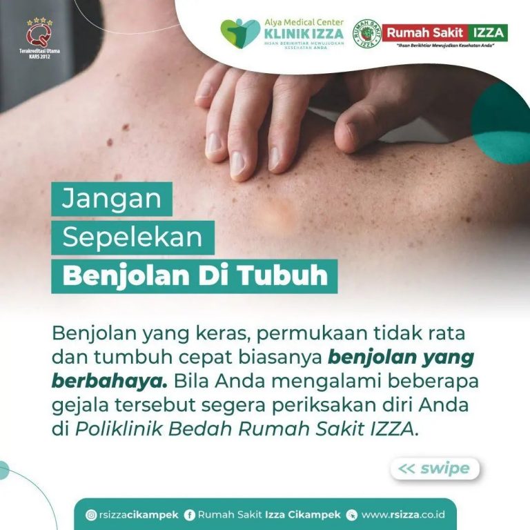 Waspada Benjolan di Tubuh